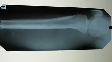 Medical X-Ray Scan - Kidneys