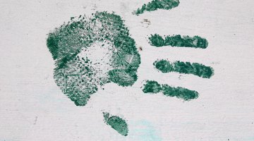 Art on soft splint