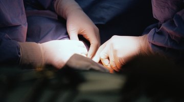 Medical X-Ray Scan - Kidneys