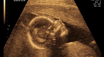 Pregnant Woman And Partner Having 4D Ultrasound Scan