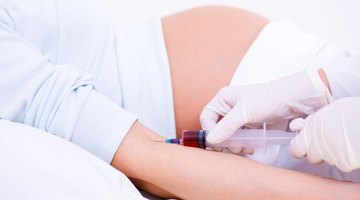 nurse taking blood sample from patient's arm. Preparation of blood to procedure Plasmolifting.