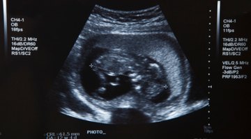Pregnant Woman And Partner Having 4D Ultrasound Scan