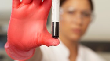 Doctor's medical notes and blood samples.